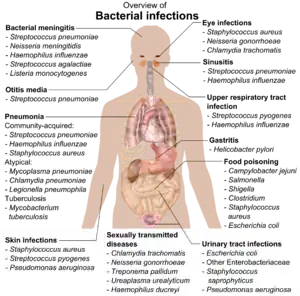 chart showing bacterial infections upon various parts of human body