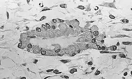 Light micrograph of undecalcified tissue displaying osteoblasts actively synthesizing osteoid (center).