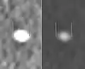 Measurement of a 5.6 mm large kidney stone in soft tissue versus skeletal CT window.