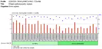 CXorf66 Protein Presence in Dilated Cardiomyopathy Septum Tissue