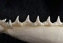 Lower teeth