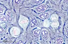 The photo depicts a culture of HeLa cells. They are stained in a light blue-purple color and seem to be in different phases of division. They look like abnormally shaped circles and are all squished in next to each other.