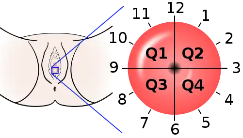 The location of cervical cancer can be described in terms of quadrants, or corresponding to a clock face when the subject is in supine position.