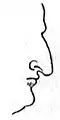 Rhinoplasty: Nasal Class IV. The Hawk nose. (Nasology Eden Warwick, 1848)