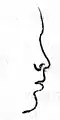 Rhinoplasty: Nasal Class V. The Snub nose. (Nasology Eden Warwick, 1848)