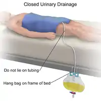 Closed Urinary Drainage Illustration