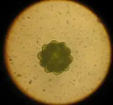 Coenobium of Coelastrum sp.