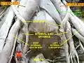 Common iliac arteries