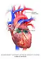 Coronary artery bypass graft, single bypass