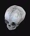 infant skull.