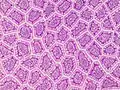 Cross-section histology of small intestinal villi of the human terminal ileum.