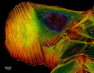 A z-projection of an osteosarcoma cell, stained with phalloidin to visualise actin filaments. The image was taken on a confocal microscope, and the subsequent deconvolution was done using an experimentally derived point spread function.