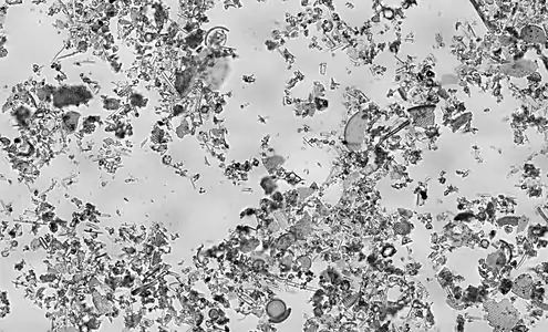 Diatomaceous earth is a soft, siliceous, sedimentary rock made up of microfossils in the form of the frustules (shells) of single cell diatoms(click 3X to fully magnify)