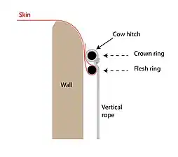 Schematic of two-ring skin mounting