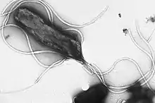 Multiple flagella in lophotrichous arrrangement on surface of Helicobacter pylori