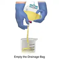 How to empty the urinary drainage bag Illustration.