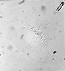 Myxobolus cerebralis, a myxosporean parasite, causes whirling disease in farmed salmon and trout and also in wild fish populations.
