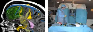 Left: 3D rendering. Right: Open MR system