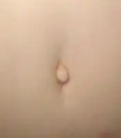 An Outie navel