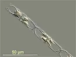 Guinardia delicatula, a diatom responsible for algal blooms in the North Sea and the English Channel