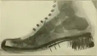 1920 US Marine Corps shoe, with high heel, showing position of foot bones (vertical black marks on the x-ray are nails used to hold the sole and heel on)