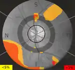 GDx - Deviation map