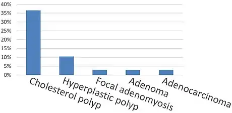 Gallbladder polyp types by relative incidence.