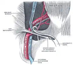 The spermatic cord in the inguinal canal