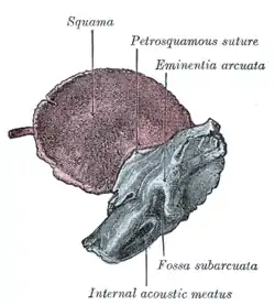 Figure 8 : Temporal bone at birth. Inner aspect.
