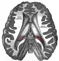 Transverse dissection showing the ventricles of the brain.