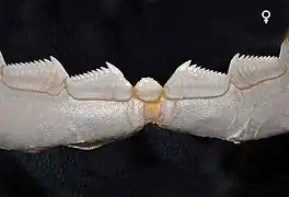 Lower teeth, female