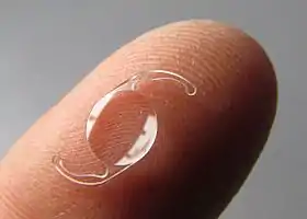 A one-piece intraocular lens resting on a fingertip for scale. The lens is about a quarter of the finger's width in diameter and has flexible haptic loops on opposite sides, which roughly double the length.