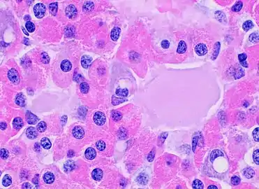 Eosinophilic follicles are a common normal finding in the anterior pituitary.