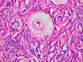 Primordial ovarian follicle. The oocyte is surrounded by a single layer of flat granulosa cells.