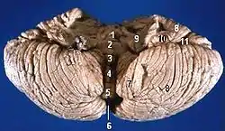 Anterior view of the human cerebellum, with numbers indicating salient landmarks