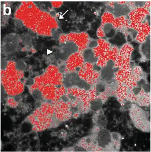 Electron spectroscopic imaging of iron (red) outside of neuromelanin organelles