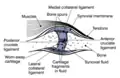 With osteoarthritis, the cartilage becomes worn away. Spurs grow out from the edge of the bone, and synovial fluid increases. Altogether, the joint feels stiff and sore.