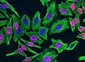 Ki-67 protein (red), tubulin (green) and DNA (blue) in HeLa cells. Dividing cells show strong Ki-67 staining in cell nuclei while all cells contain large amounts of tubulin, the major component of microtubules. Antibodies, cell staining and image courtesy of EnCor Biotechnology.