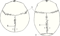 Top view of cranial suture.