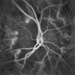 Blood flow in the optic disc revealed by holographic laser Doppler imaging.