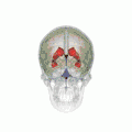 Position of lateral ventricles (shown in red).