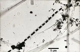 Microscopic view of Leptothrix individuals