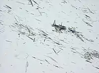 Light microscopy of a touch preparation of a gout tophus, showing needle-shaped crystals.