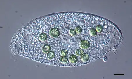 Species of Loxodes containing significantly large green-colored algae. Scale bar: 10 µm.