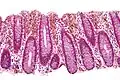 Micrograph of melanosis coli. H&E stain.