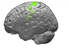 Left motor cortex highlighted on the brain