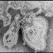 TEM micrograph of a mumps virus particle