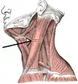 Sternocleidomastoid muscle