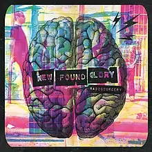 A photo of all the band's members sitting near a wall looking at the city with a heart beating in the background and 3 electric shocks coming out of it. What goes along with the image is the three cards that were seen in the band's second and third albums, New Found Glory and Sticks and Stones, which read "NEW", "FOUND", and "GLORY". The words "RADIOSURGERY" appear underneath with a black oval. There are a lot of stuff that go along with the background.