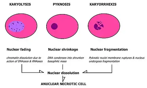 Morphological characteristics of pyknosis and other forms of nuclear destruction.